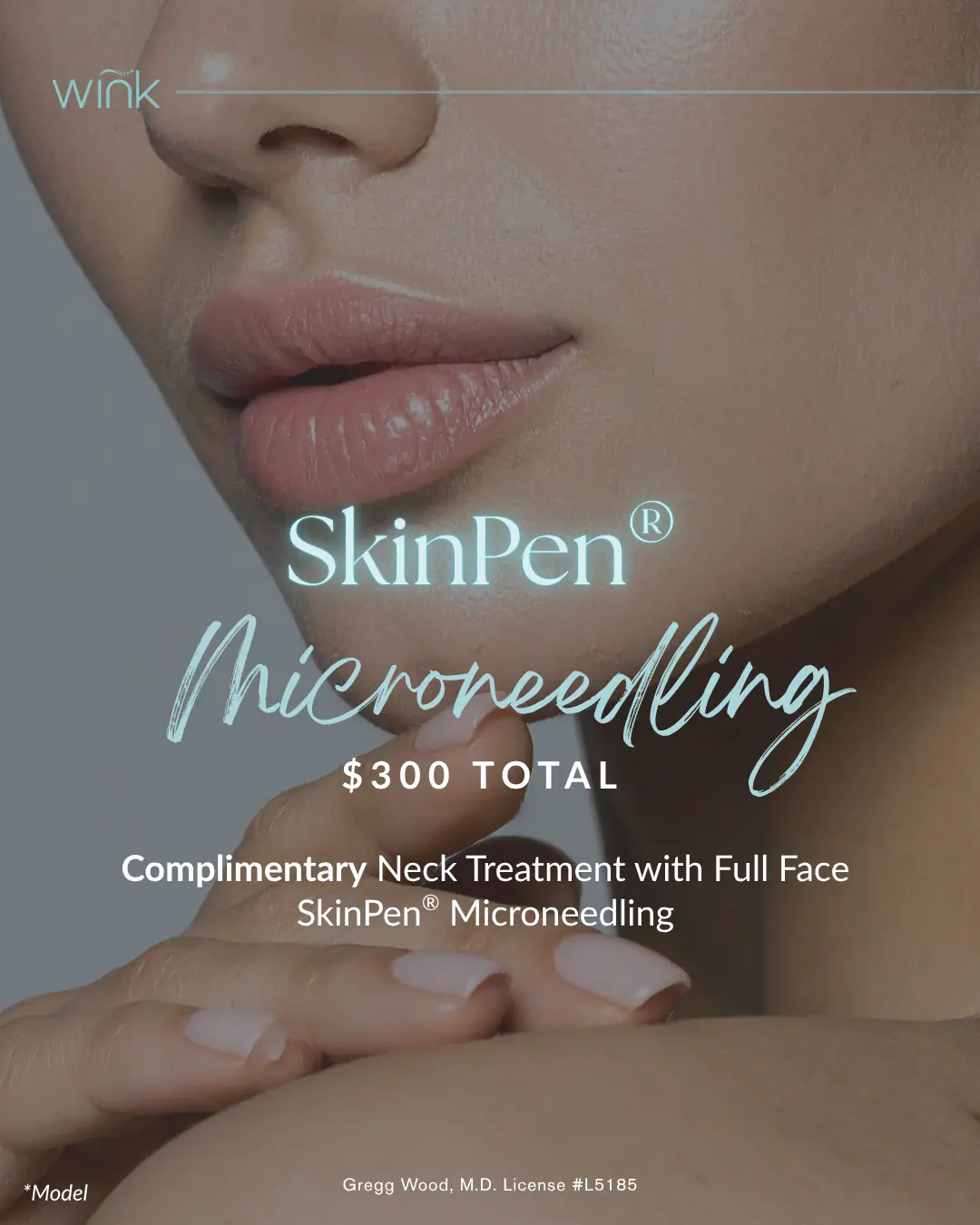 SkinPen® Microneedling — $300 Total
